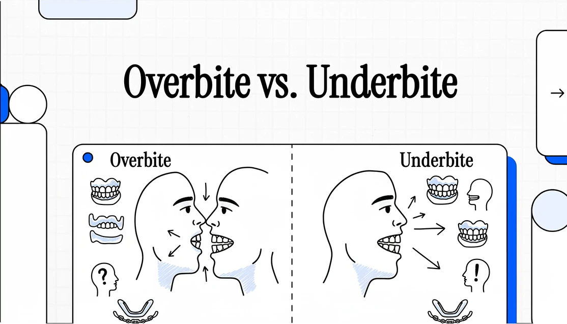 Overbite (Buck Teeth)
